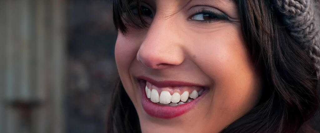 Gummy Smile Treatment