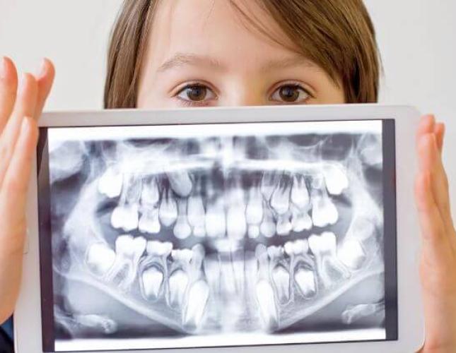 Dental X-Rays: 7 of Your Top Questions, Answered!